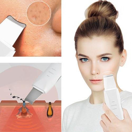 Pala Facial Exfoliante Ultrasónica
